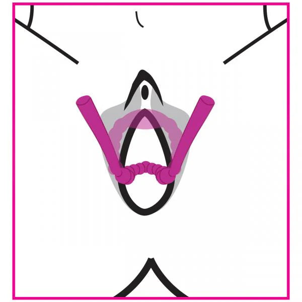 Flexible Petal Pusher Silicone Labia Spreader - This innovative labia spreader device opens up for intimate pleasure, crafted with body-safe materials.