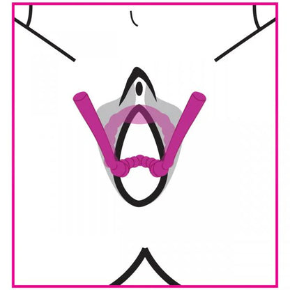 Flexible Petal Pusher Silicone Labia Spreader - This innovative labia spreader device opens up for intimate pleasure, crafted with body-safe materials.